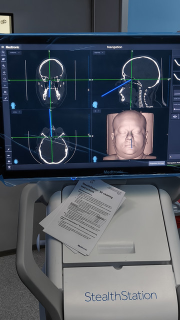Neuronavigation system