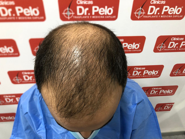 preop1