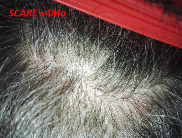 Scare-4mo-1.jpg