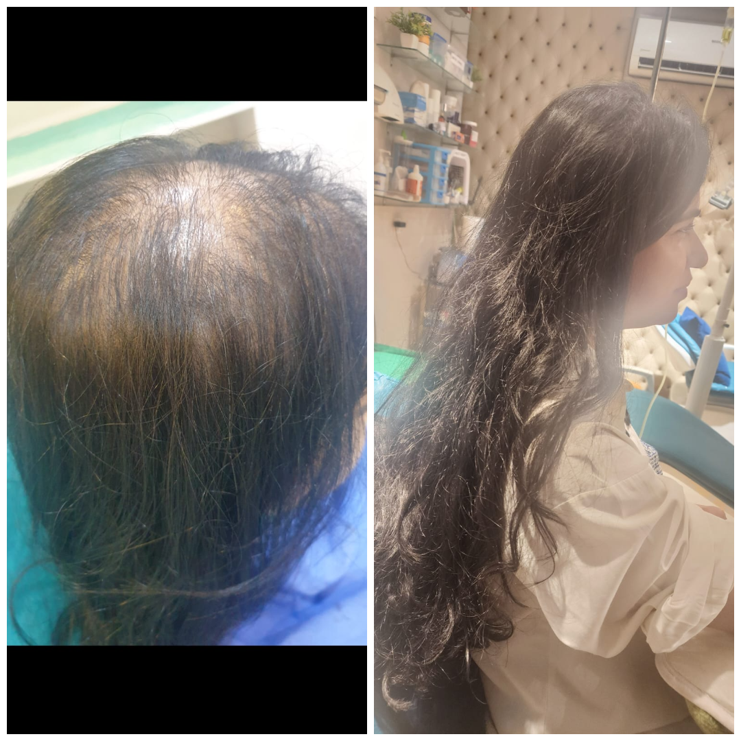 Real patient result