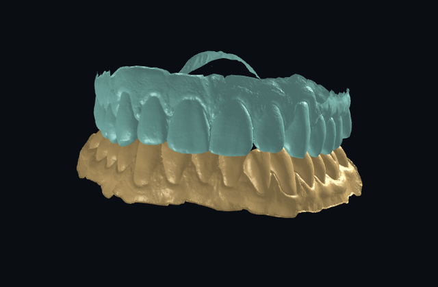occlusion 1.png