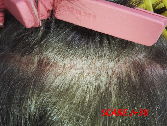 scare-1mo-3.jpg