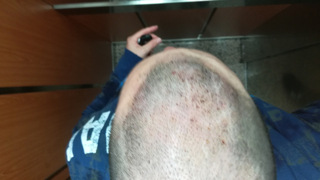 dav