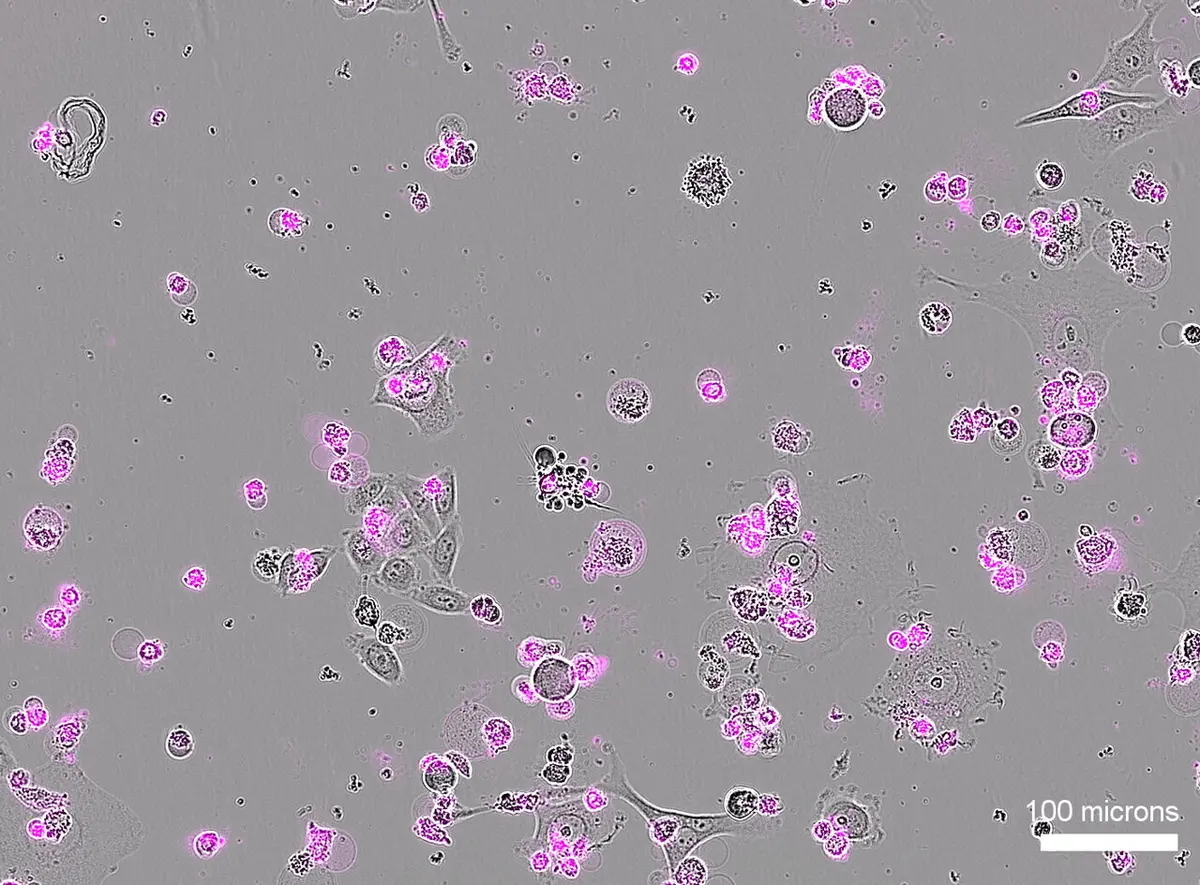 CRISPR System Targets Cells for Destruction, Shows Promise Against Disease