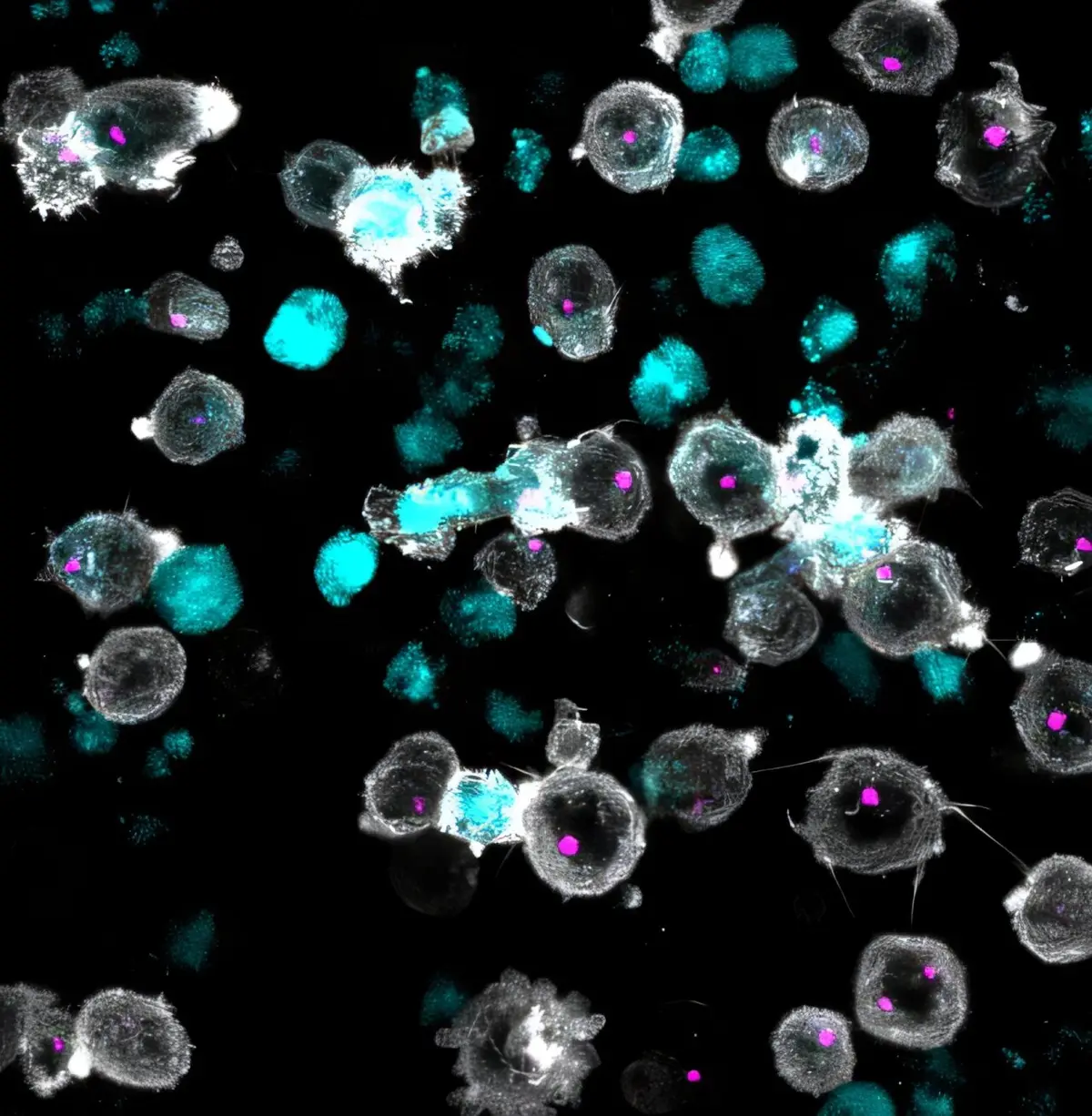 CAR-T Cells Get Navigation Boost to Fight Cancer