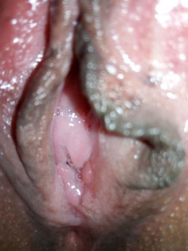 334827832-52 334827832-52