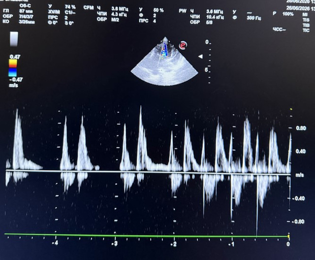 Screenshot 35