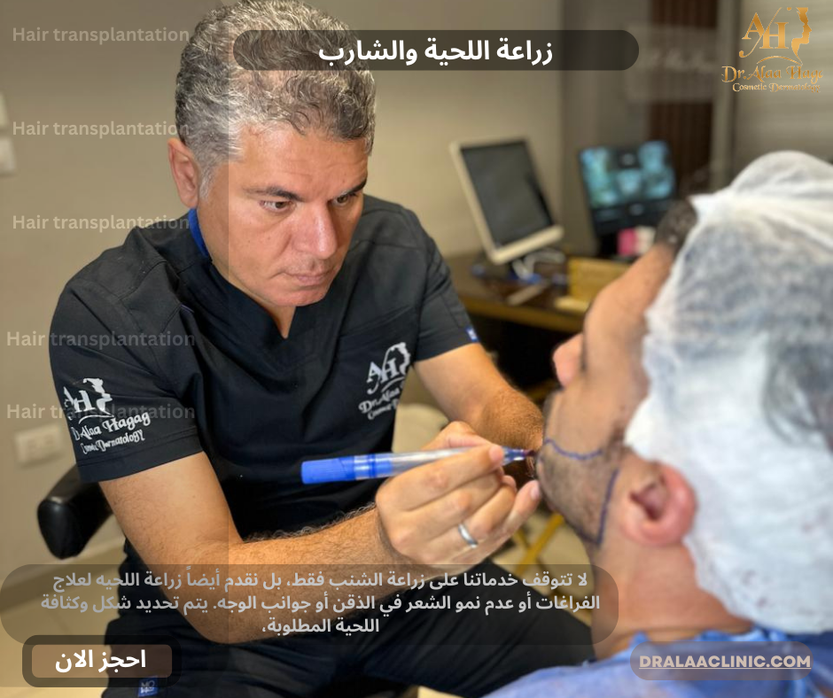 د. علاء حجاج يحدد مناطق زراعة اللحية والشارب بقلم الرسم الطبي