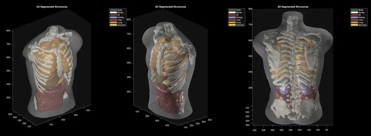 Midjourney's Medical Scanner Raises More Questions Than Answers