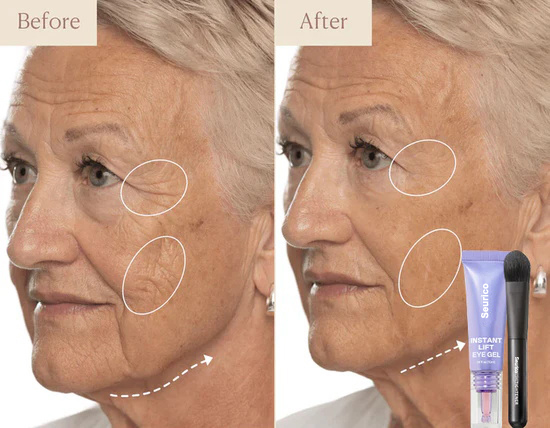 Before and after eye gel result 3