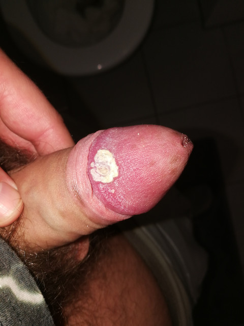 dav