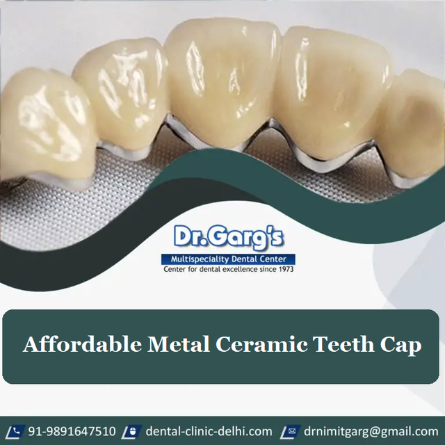A tooth cap placed to cover the weak tooth or severely discolored teeth restores its shape, size, and strength. Dr. Garg’s Multispeciality Dental Center in Delhi offers the lowest prices of metal-ceramic teeth caps with the surety of a world-class dental treatment facility.

https://dental-clinic-delhi.com/dental-crown

#metalceramicteethcapprice #metalceramiccrown #metalceramictoothcap #metaltoothcap #ceramiccapforteeth #ceramiccrown