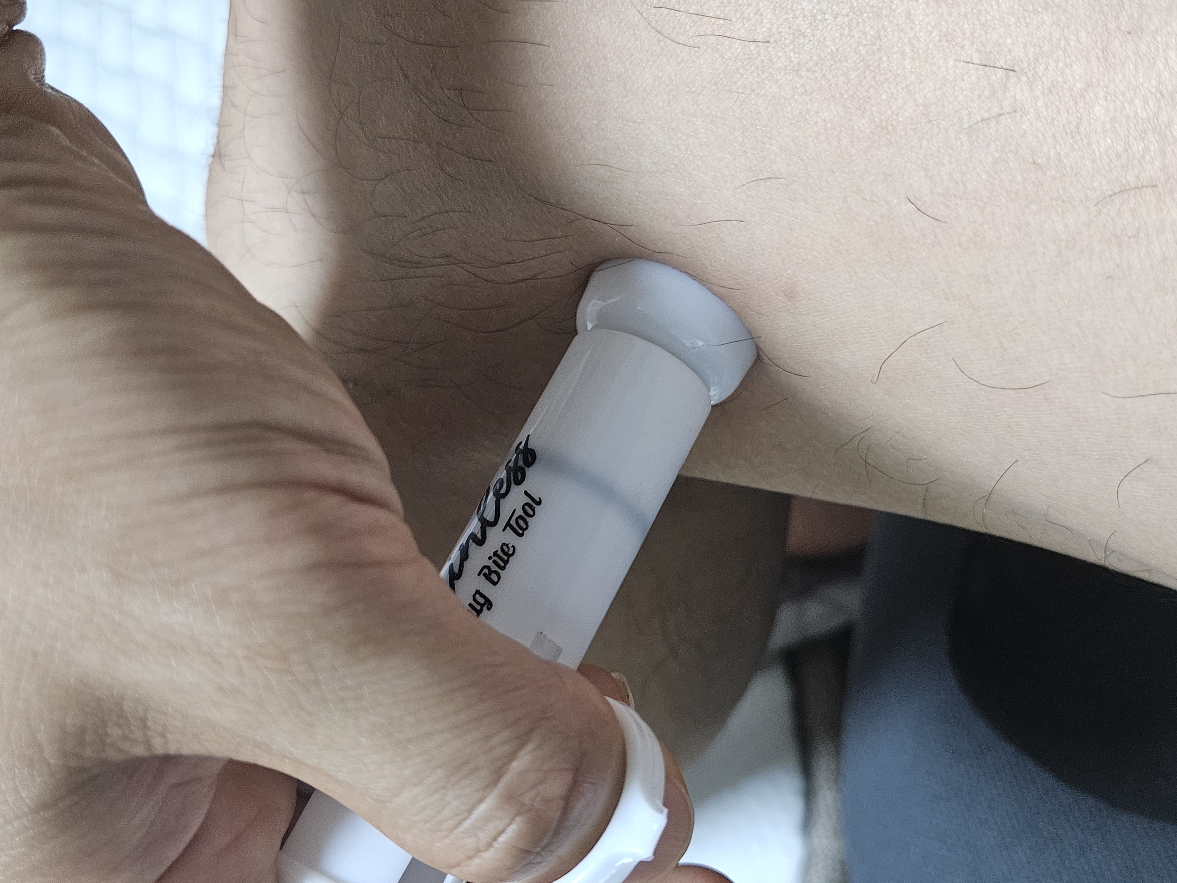 모기 독 제거기 모기 물린 자리에 밀착 사용