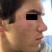 post-revision-profile