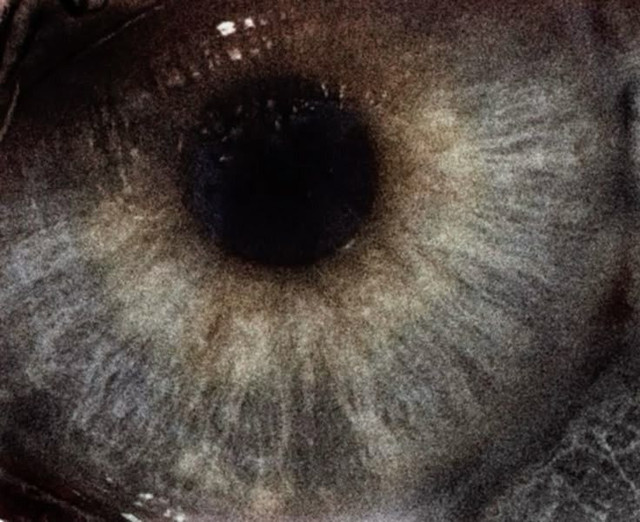 eye