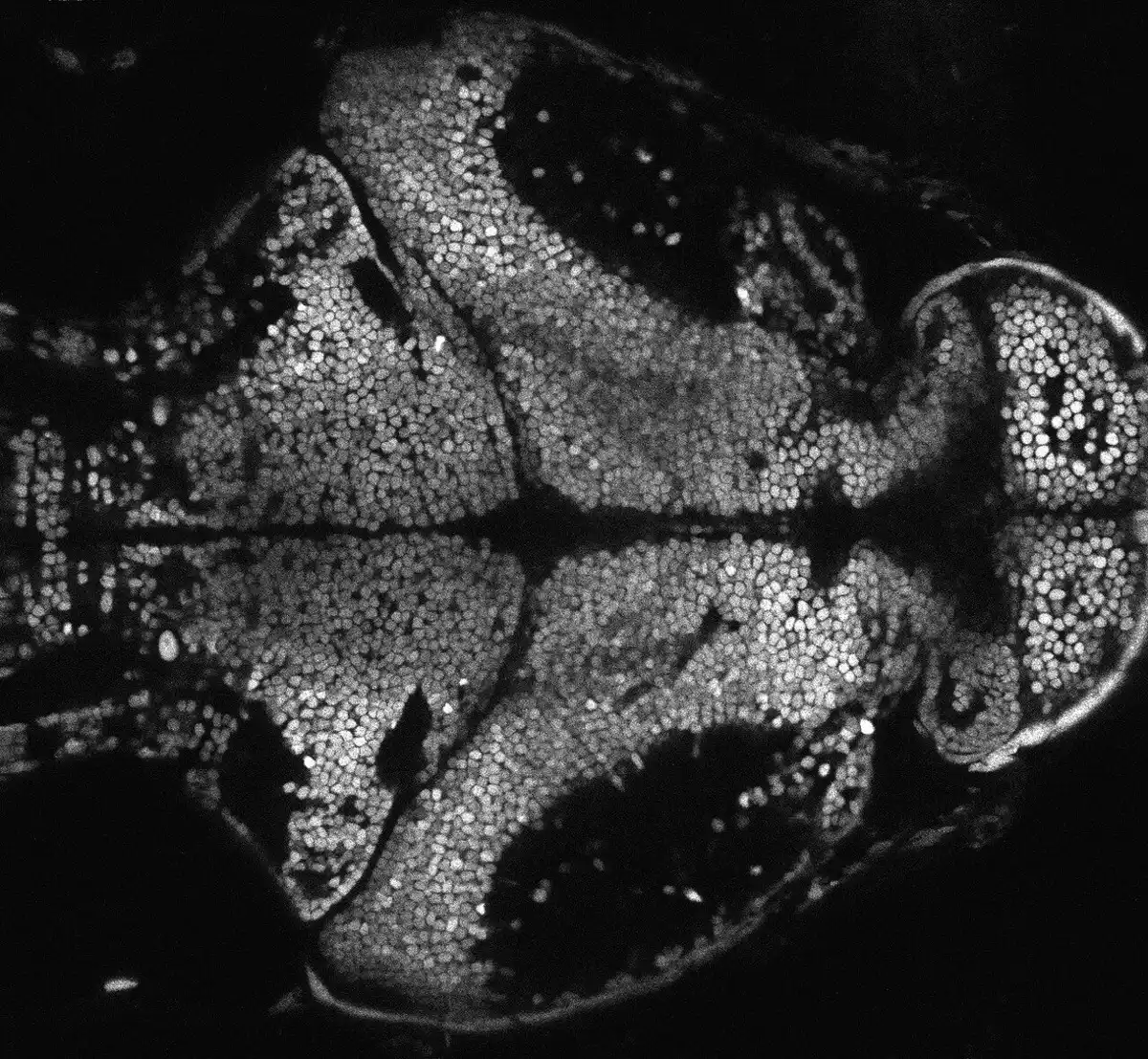 Tiny Genetic Fragments Key to Brain's Resting State