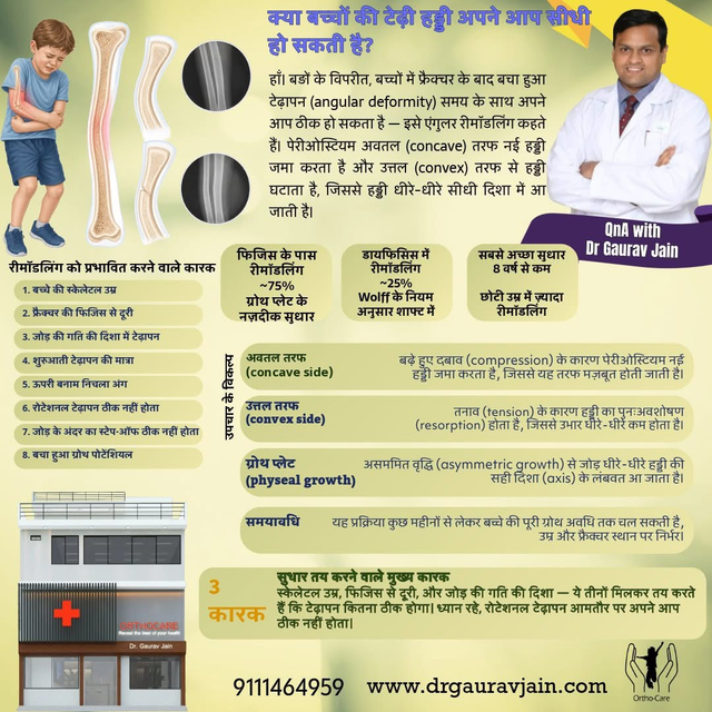 क्या बच्चों की टेढ़ी हड्डी अपने आप सीधी हो जाती है? हड्डी की रीमॉडलिंग का जादू समझिए