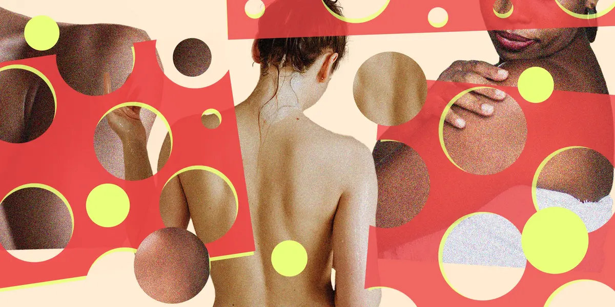 Skin Bumps: A Dermatologist's Guide