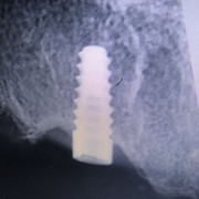 IMG-c32a30a964cf1face05b3ecc5367c9f1-V.j