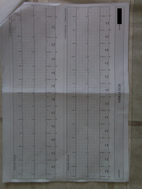 EKG-10