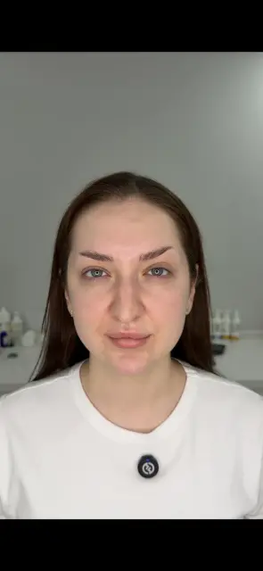 Лоб после