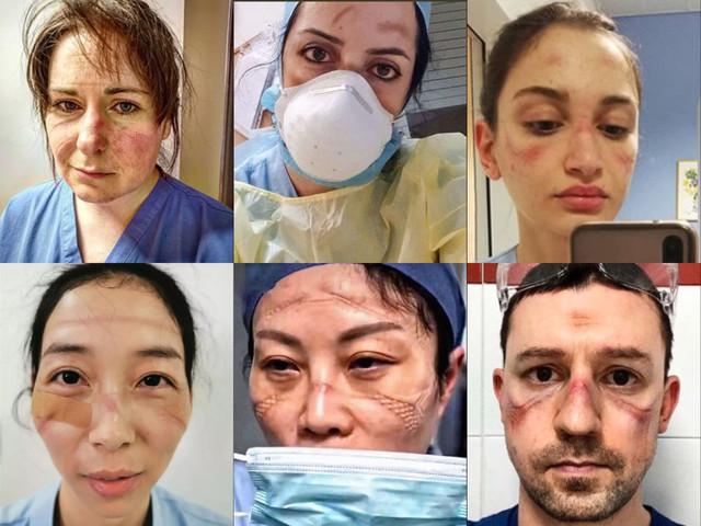 nurses-on-ppe