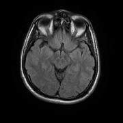 30054