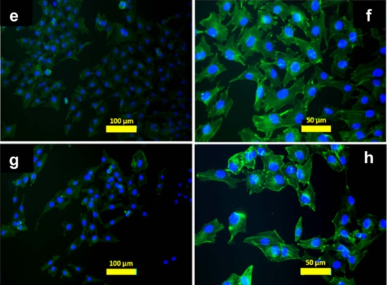 Injectable polyelectrolyte complex-nascent HAP biodegradable antibiotic delivery system for the treatment of osteomyelitis