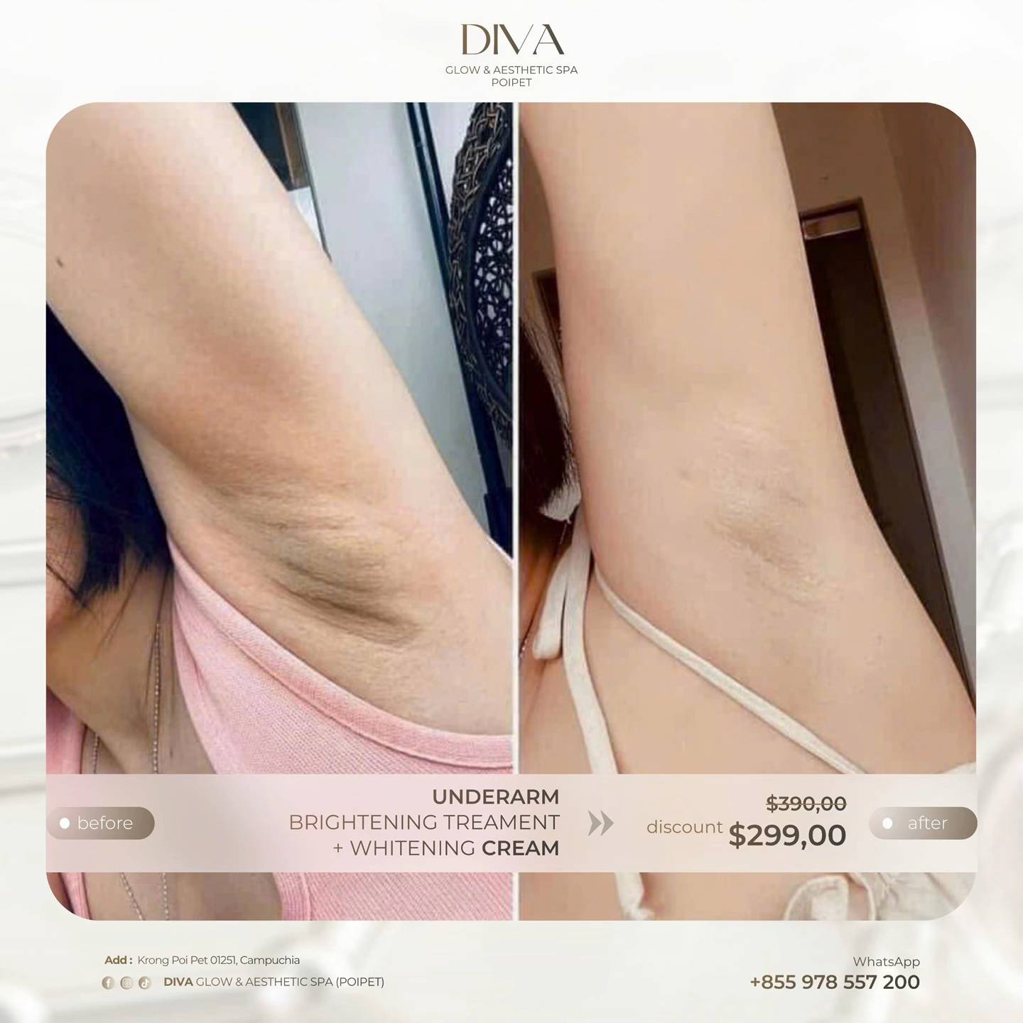DIVA Skin Clinic Poipet