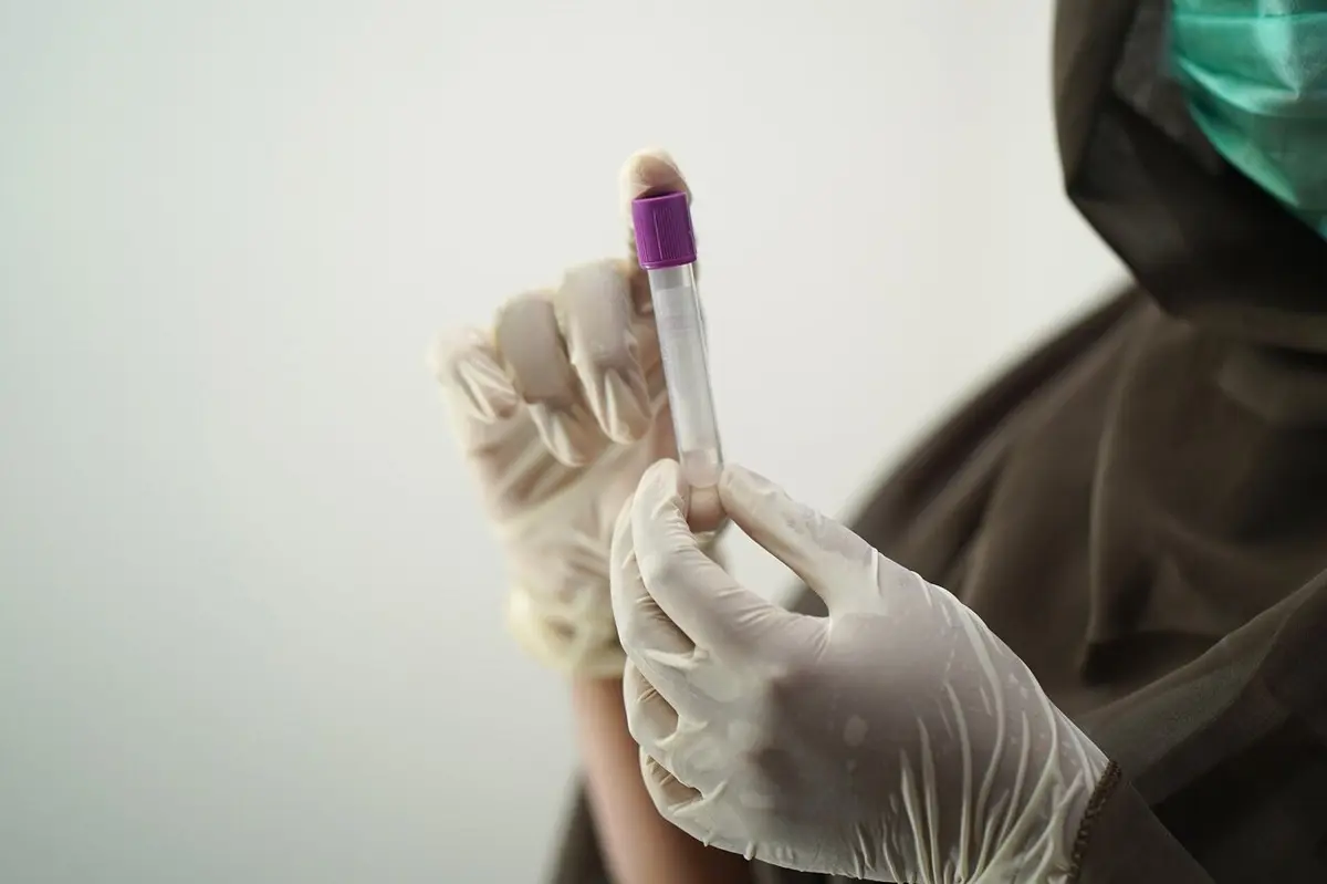 Roche Receives EU Approval for Early Alzheimer's Blood Test