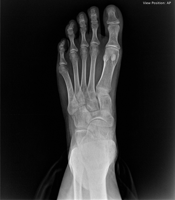 foot top.png