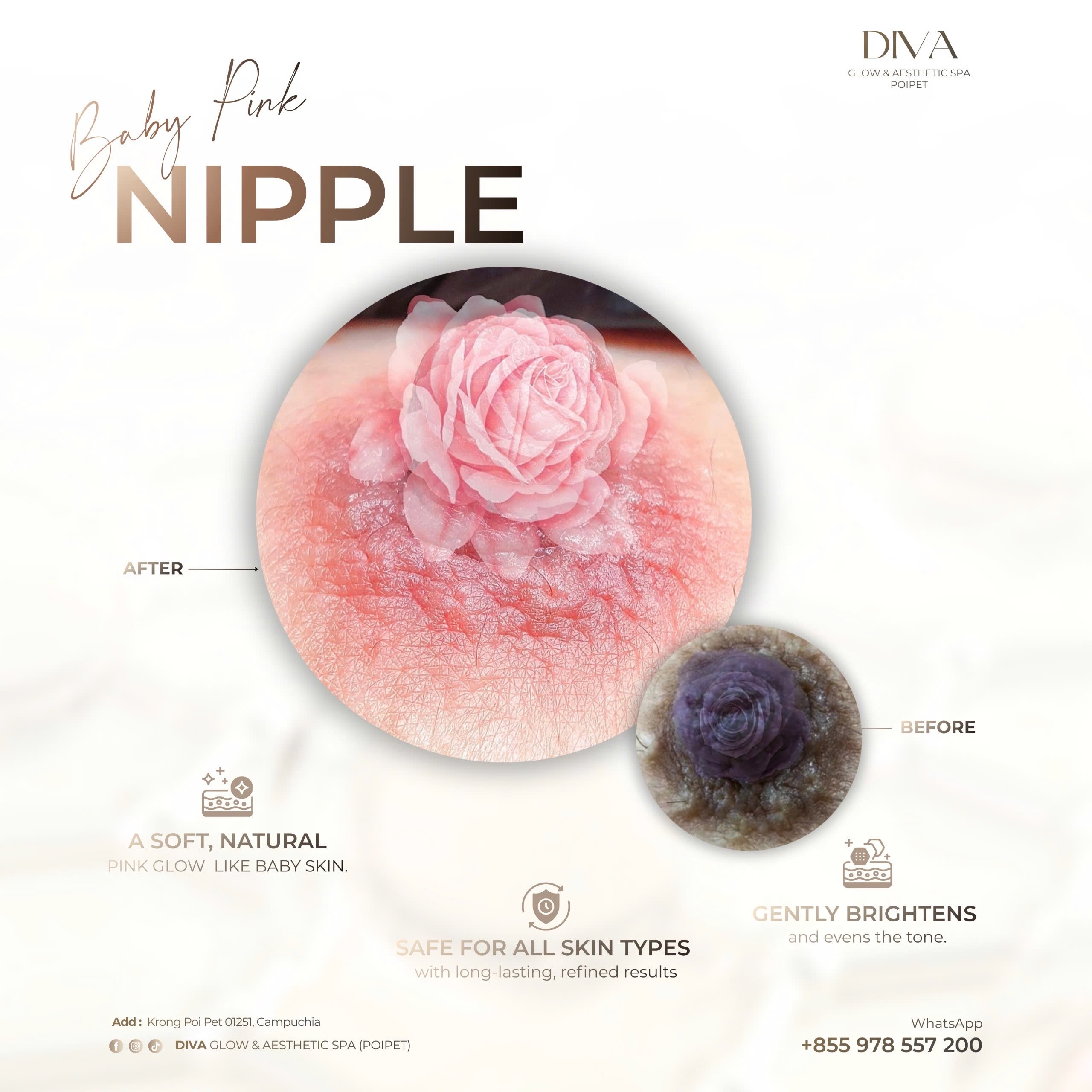 DIVA Skin Clinic Poipet