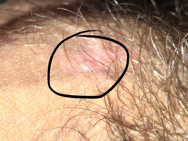 IMG 3938