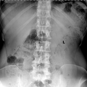 xray5