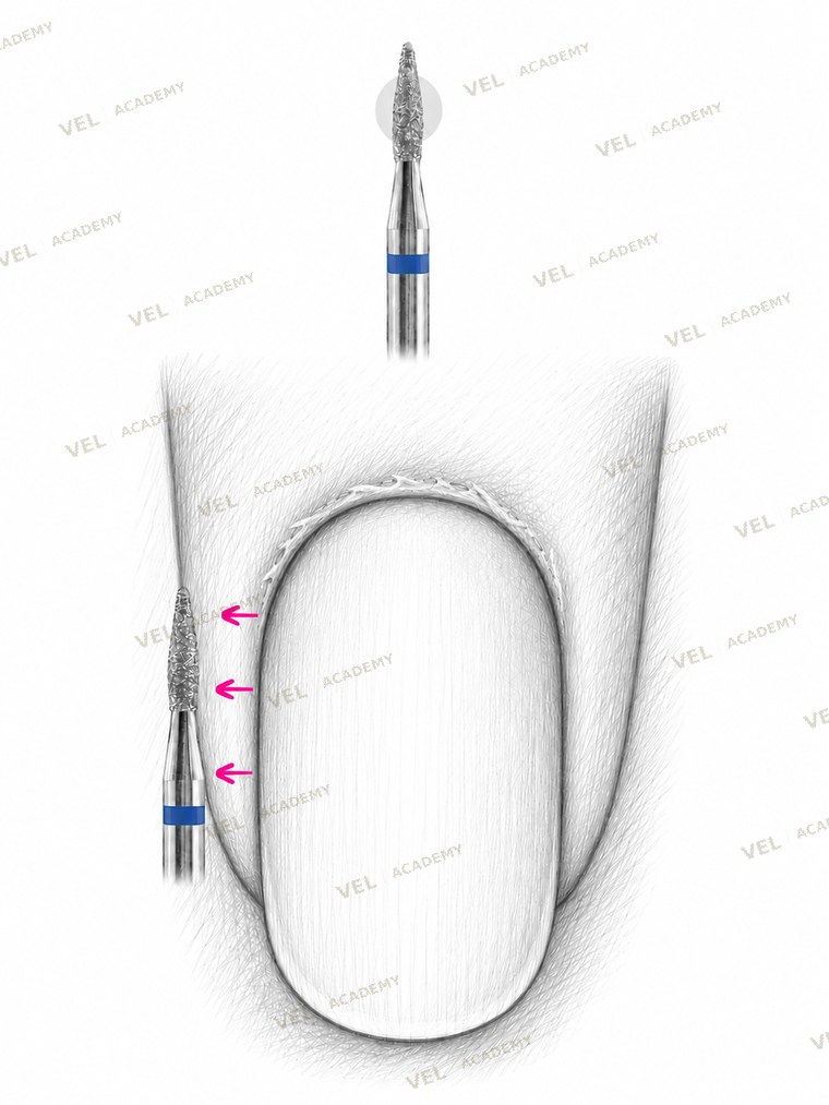 FWD step 2 opening lateral groove long diagonal stroke