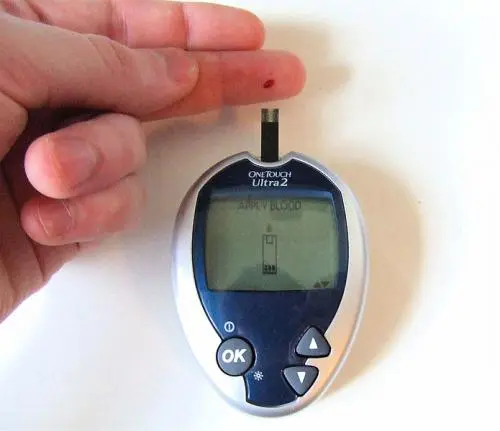 Young Women Drive Rise in Early-Onset Type 2 Diabetes in England