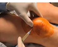 PRP Preparation Lab
