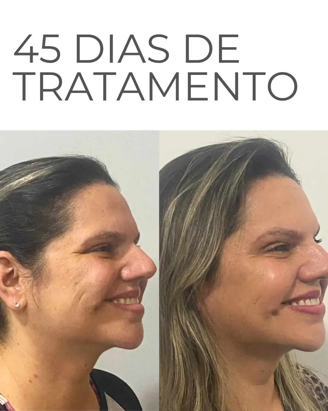Kelly, 50 anos